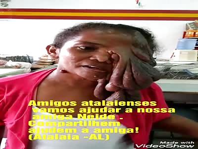 woman with terrible disease on her face