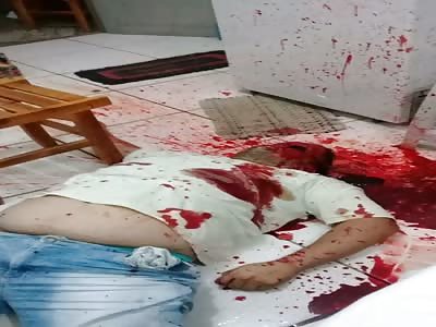 Man Blew His Face Off With a Shotgun.