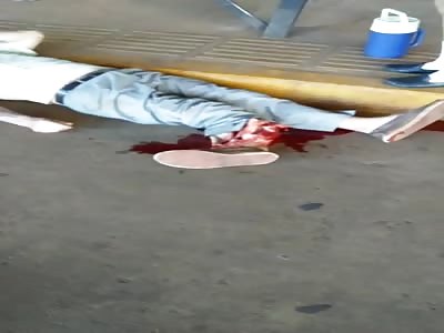 man have leg smaeshed 