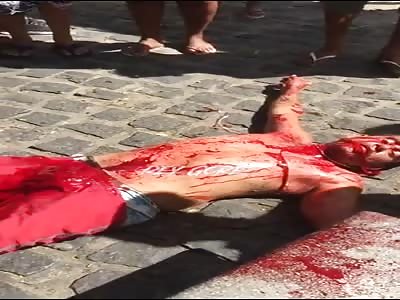 man was stabbed in fight