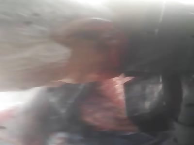 Old Man in Shock with Machete Inflicted Wounds to Face