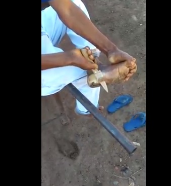  Nasiest Thing I've Ever Seen