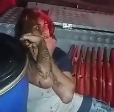 Drug Turned this Bitch Into a Full Blown Zombie