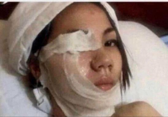 Bitch Tried to Pour Acid on BF Wind Blows it On Her Instead.