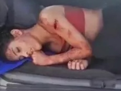 Girl was Shredded with Bottles by Her Crazy Ex