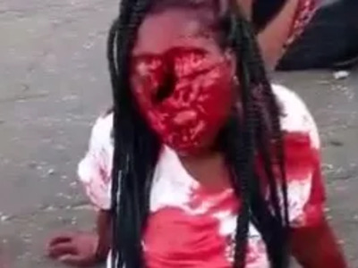 Girl had a Face Lift.