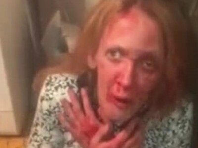 Woman Brutally Tortured (Possibly Dead)