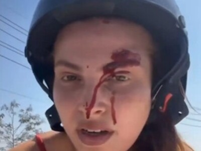 Attention Whore Wants Attention After Crashing