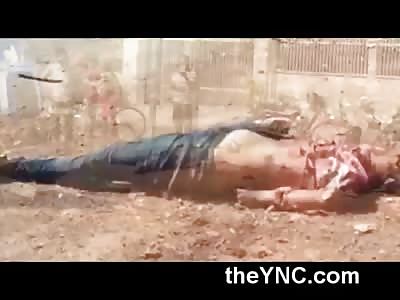 Mans Torso and Head Crushed after Horrific Accident