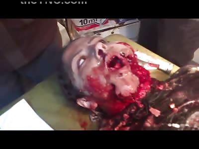 Woman with Horrible Facial Injuries in Absolute Shock in the ER