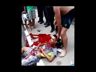 Trying to Comfort the Man Dying in Total Agony after Being Shot