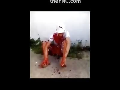 Young Man Shot in the Mouth Waits Patiently for Help 