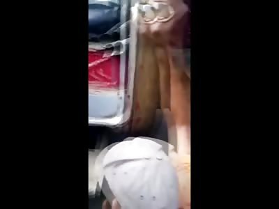 In one of the Most Bizarre Accidents a Man has his Head Crushed by the Bed of his Own Truck