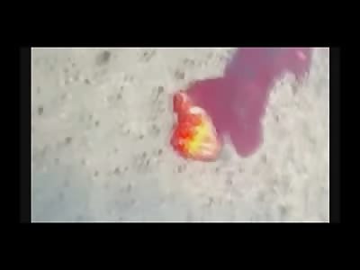 Gruesome Footage shows a Mans Head Ripped Off and His Heart Still Beating in the Street (2 Cell Phones)