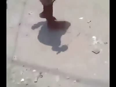 Man involved in Machete Fight begins to Die from Blood Loss 