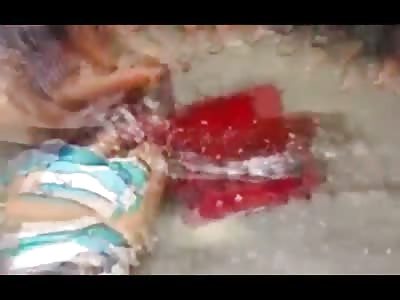 Picking up Pieces of Brain and Returning it to the Crushed Head