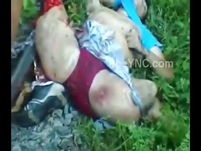 Man with Both legs Ripped off by Train Agonizing to Death