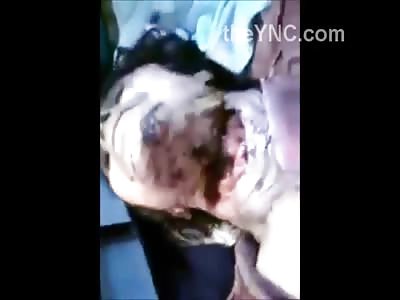 Woman With her Neck Slashed Still Alive 