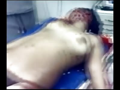 Topless Girl in Bikini Underwear Laid Out... Shot Many Times in the Face 