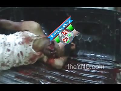 Man Shot in the Face Still Alive in Pure Agony with Huge Hole in his Eye