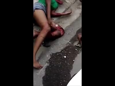 Poor Girl With Leg Severely Wounded Waits Calmly For Help