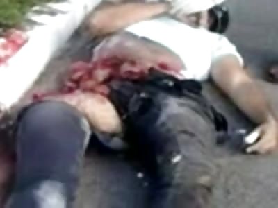 Biker Trying to Hang on With his Guts Hanging Out