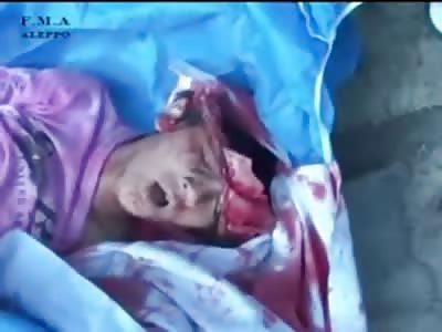 Boy with Head Blown OFF still Reflex Breathing in Final Resting Place 