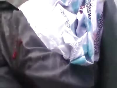 SAD: Female Toddler has her Brain Exposed lying Next to her Dead Mother 