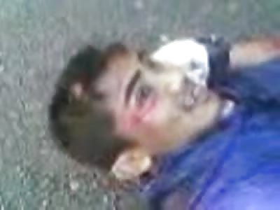 Mangled Leg is Hard to Look at......Gross!!