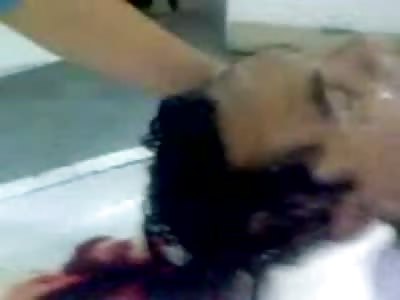 His Brain Just Plops Out