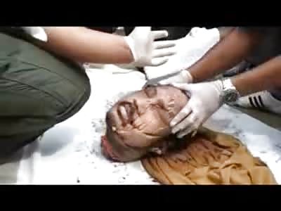 The Suitcase Killer....Gruesome Murder Scene as Chopped Up Body is Removed from the Hotel Luggage