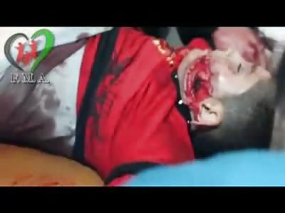 Poor Kid Shot in the Face in Total Shock Wondering Whats Going on