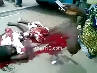 Man Horrifically Cut in Half is Still Moving Wondering Whats Going on