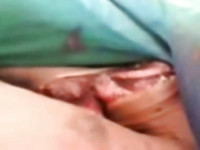 Lets just Day you were Murdered with an Ax....Well you Might Look Like This