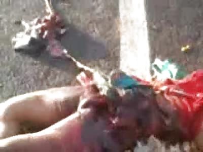 Faceless Man on the Street lies Dead after Accident