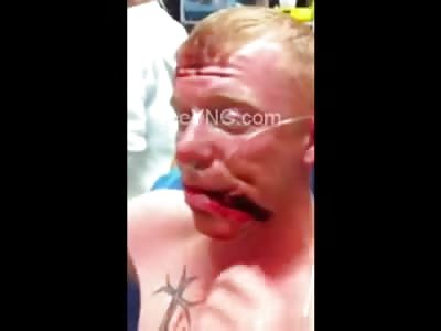 SMILE: Man is Given a Joker Smile by One Pissed off Dude in a Knife Fight