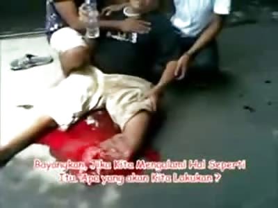 Old Mans Leg is Crushed to Nothing as he Sits in Total Shock