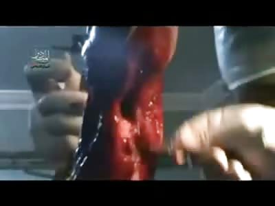 Doctors in a Dimly Lit Field Hospital