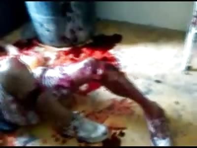 Man got into a Fight with a Man with a MAchete