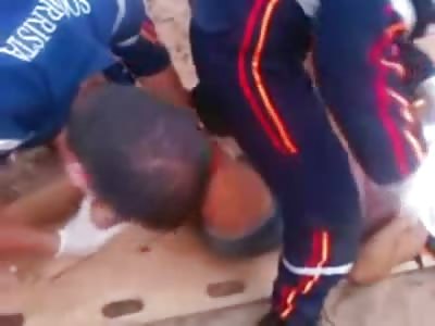 Unseen Footage of the Pretty Girl with Mangled Horrific Leg Injury 