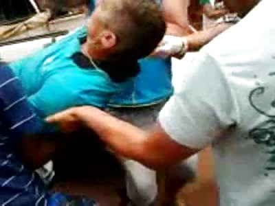 Cracked Skull and Major Bleed out on Street-