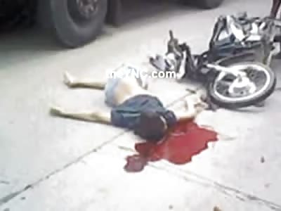 Hey Johnny Are You Alive Bro?