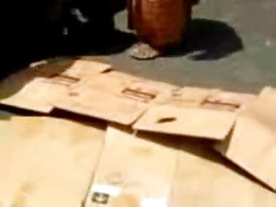 Little Muslim Toddler Missing her Legs Cut in Half 