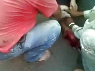 Sobbing Man Ties off His Leg to Try to Save It......