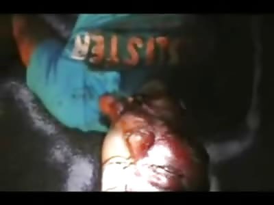 Mans Chin is GONE after Accident on the Street 