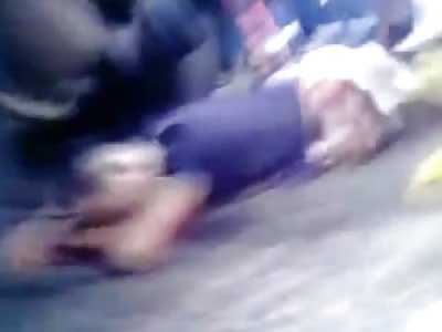 Man Cut in Half Still Completely Coherent and Wide Awake