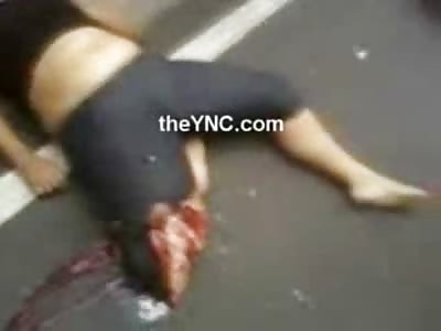 Chubby Woman sits in Shock with her Leg Crushed and Dangling Off by dome Skin