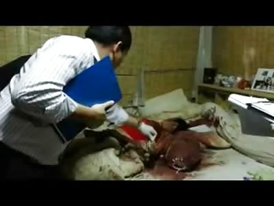 Young Married Woman Blew her Brains out all over her Bed