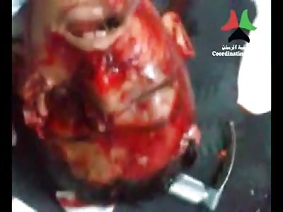 Missing his Eye and taking Final Reflexive Gasps of Air