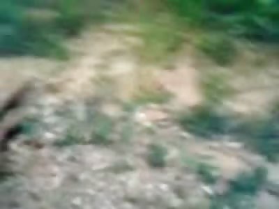 Mans Entire Brain Seeps out of his Head Following Accident